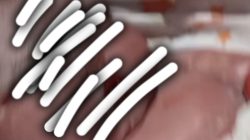 Bayi Meninggal dalam Kandungan, Diduga Usai Disuntik Dokter 