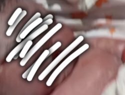 Bayi Meninggal dalam Kandungan, Diduga Usai Disuntik Dokter 