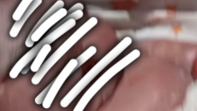 Bayi Meninggal dalam Kandungan, Diduga Usai Disuntik Dokter 